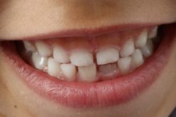 Igiene orale nei bambini: 4 regole e gli strumenti alleati